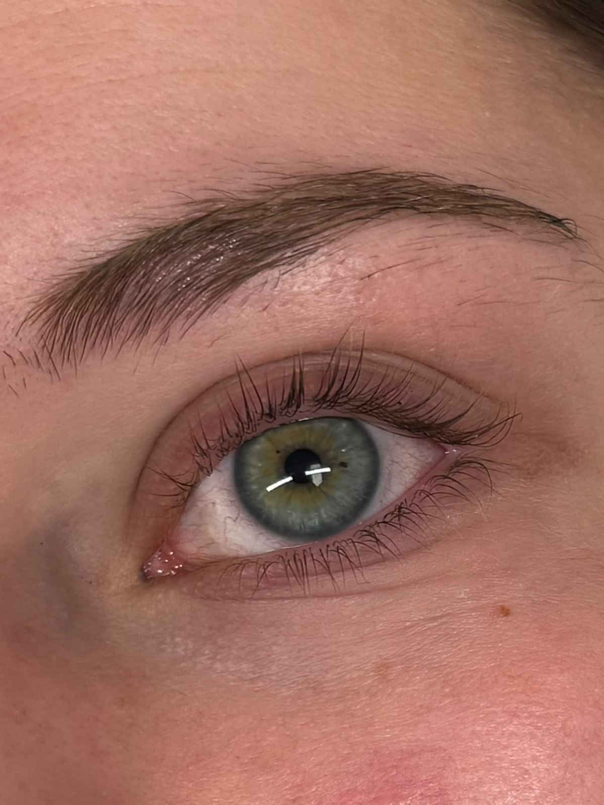 Wimpern vor der Behandlung